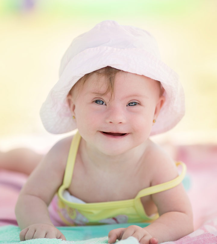 Down Syndrome In Babies: Causes, Symptoms And Treatment