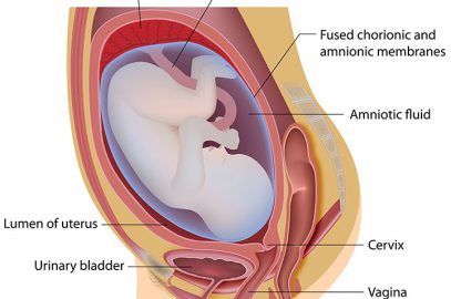 amniotic fluid leak test at home