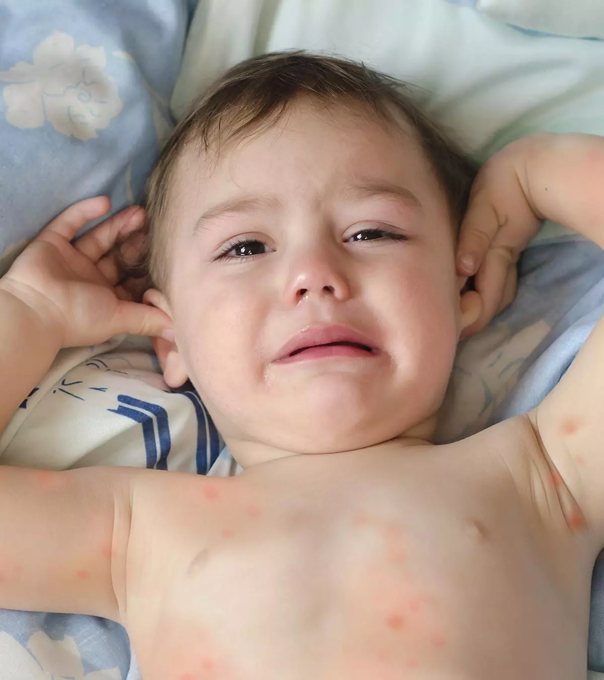 Spider Bites In Toddlers - Causes, Symptoms & Treatments