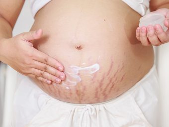 7 Home Remedies For Stretch Marks After Pregnancy