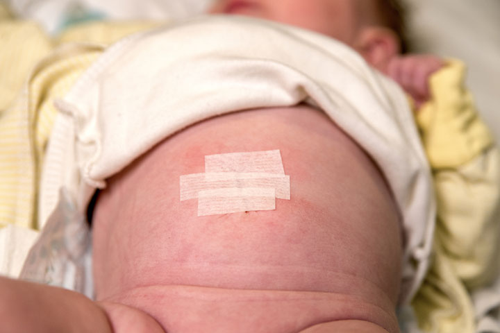 The outie hole in newborns usually closes within 12 to 18 months