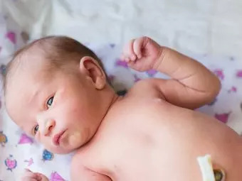 Why Does Your Newborn Have An ‘Outie’ Belly Button?