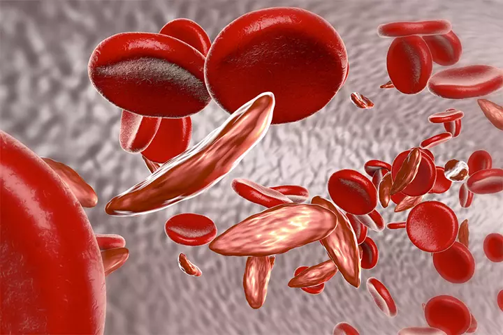 Genetic disorders such as sickle cell disease destroy blood cells.