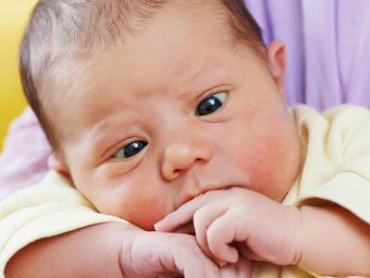 Strabismus In Babies and Infants