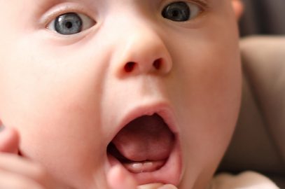 Teething In Toddlers: Symptoms And Ways To Ease The Pain