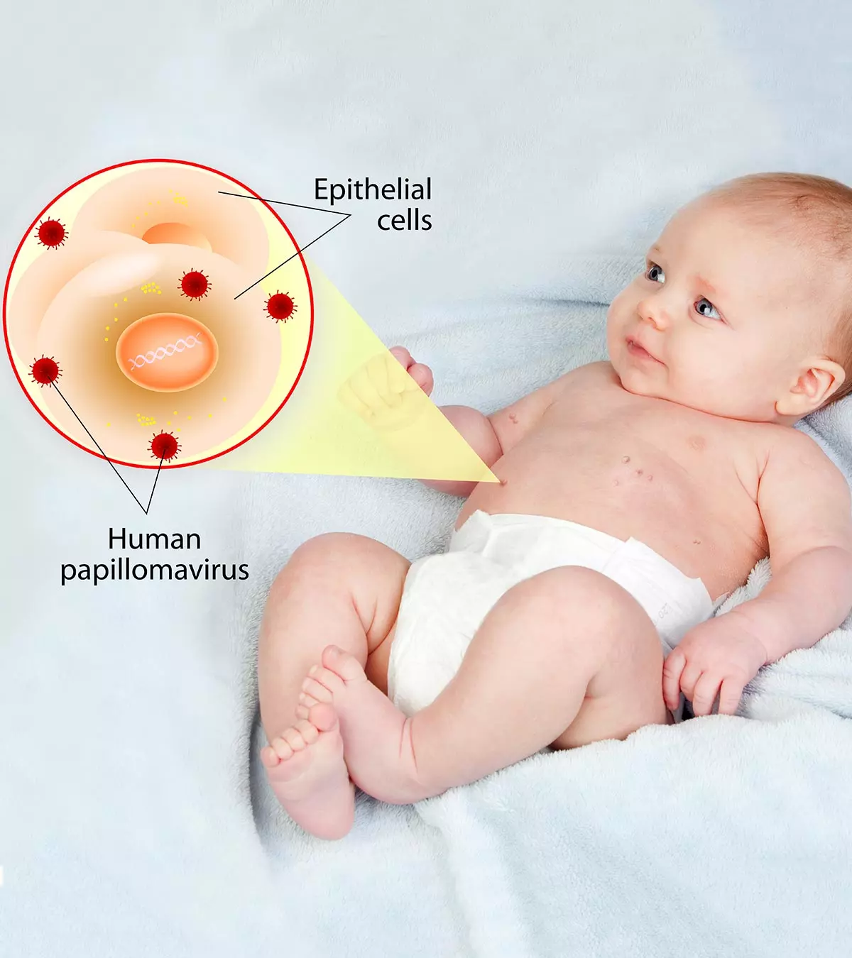 Baby With Cold Sores On Lips