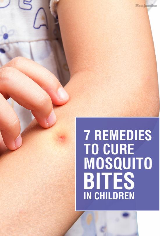 7 Home Remedies To Treat Mosquito Bites In Children