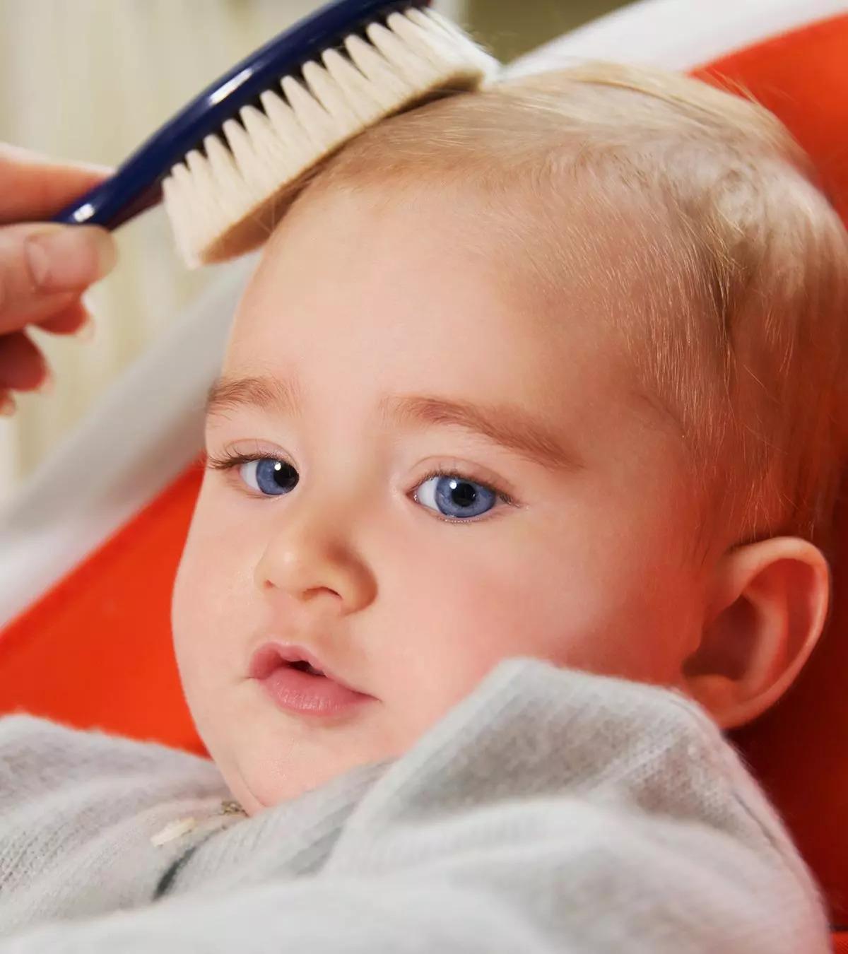 Alopecia Areata In Toddlers Everything You Need To Know