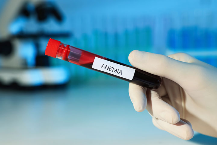 Being underweight can cause anemia in teenagers