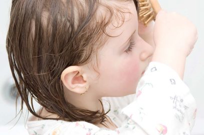 Dandruff in Toddlers: Why Does It Happen And How To Treat It