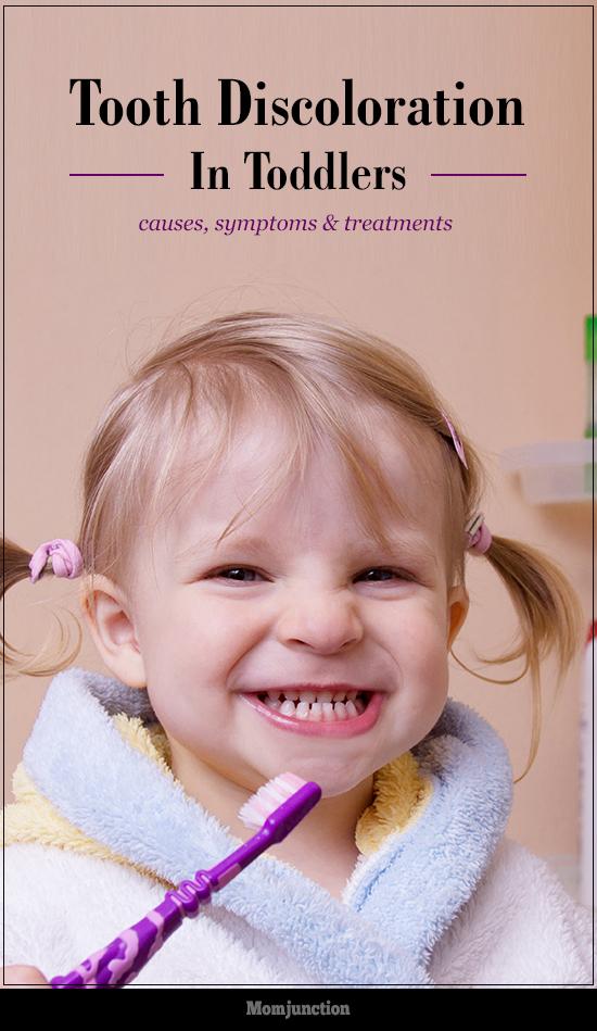 Tooth Discoloration In Toddlers Causes, Symptoms & Treatments