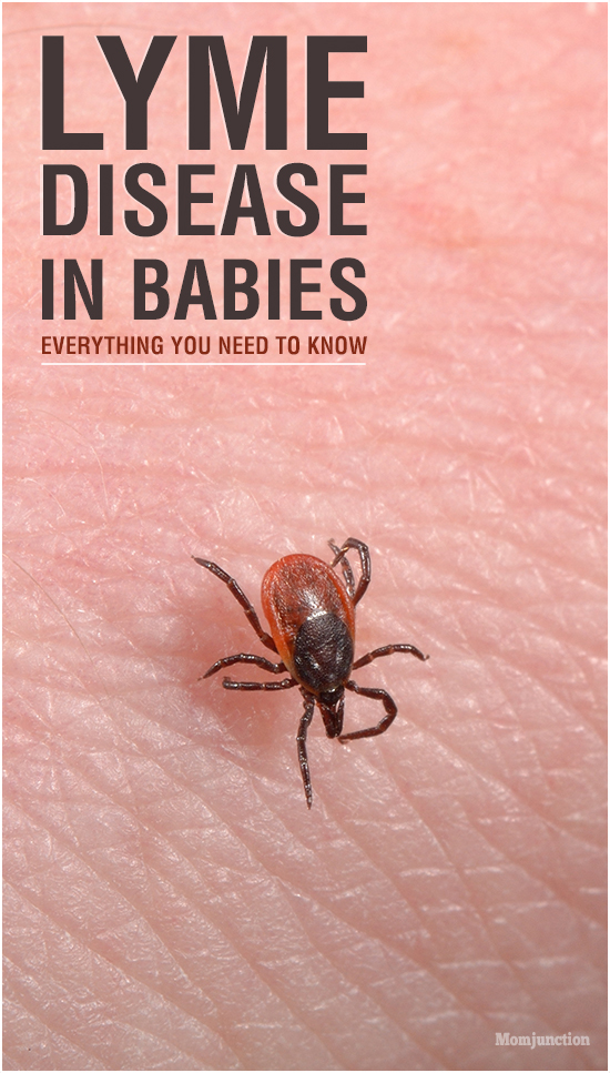 Lyme Disease In Babies - Everything You Need To Know