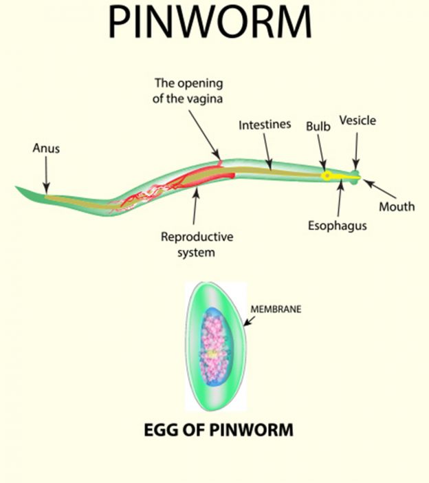 pinworm diagram)