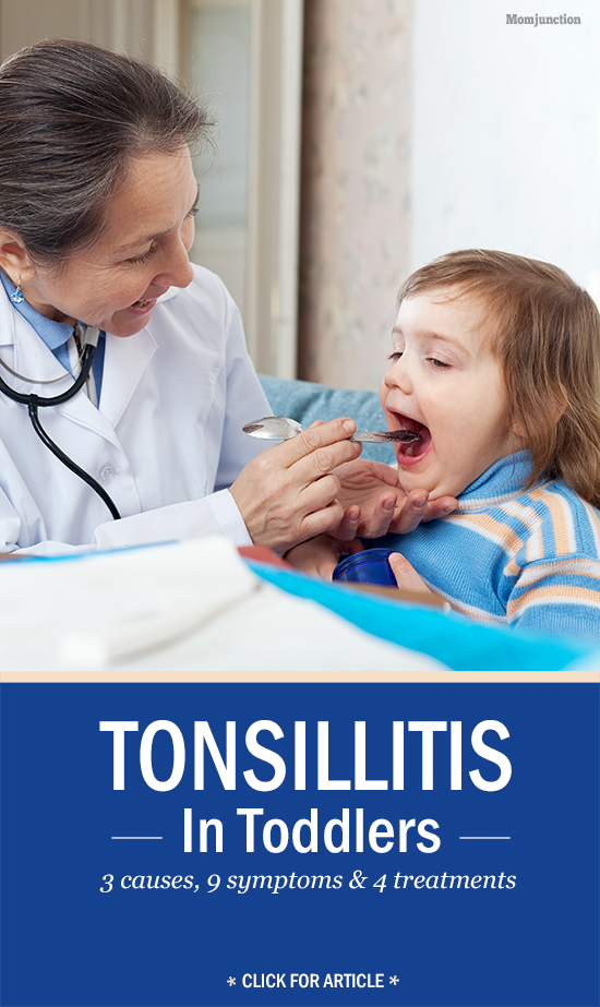 Tonsillitis In Toddlers 3 Causes 9 Symptoms And 4 Treatments You