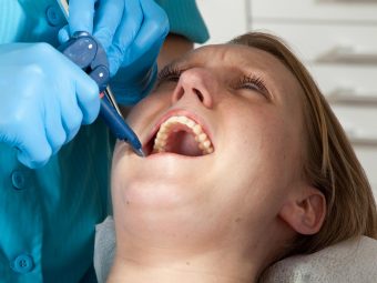 Can You Get Tooth Extraction Done During Pregnancy?