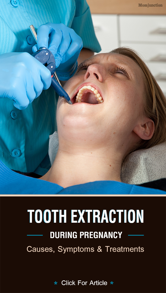 Tooth Extraction During Pregnancy Causes, Symptoms And Treatments