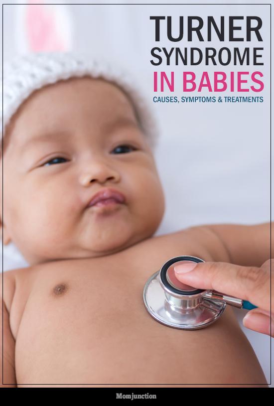 Turner Syndrome In Babies Causes, Symptoms & Treatments You Should Be Aware Of