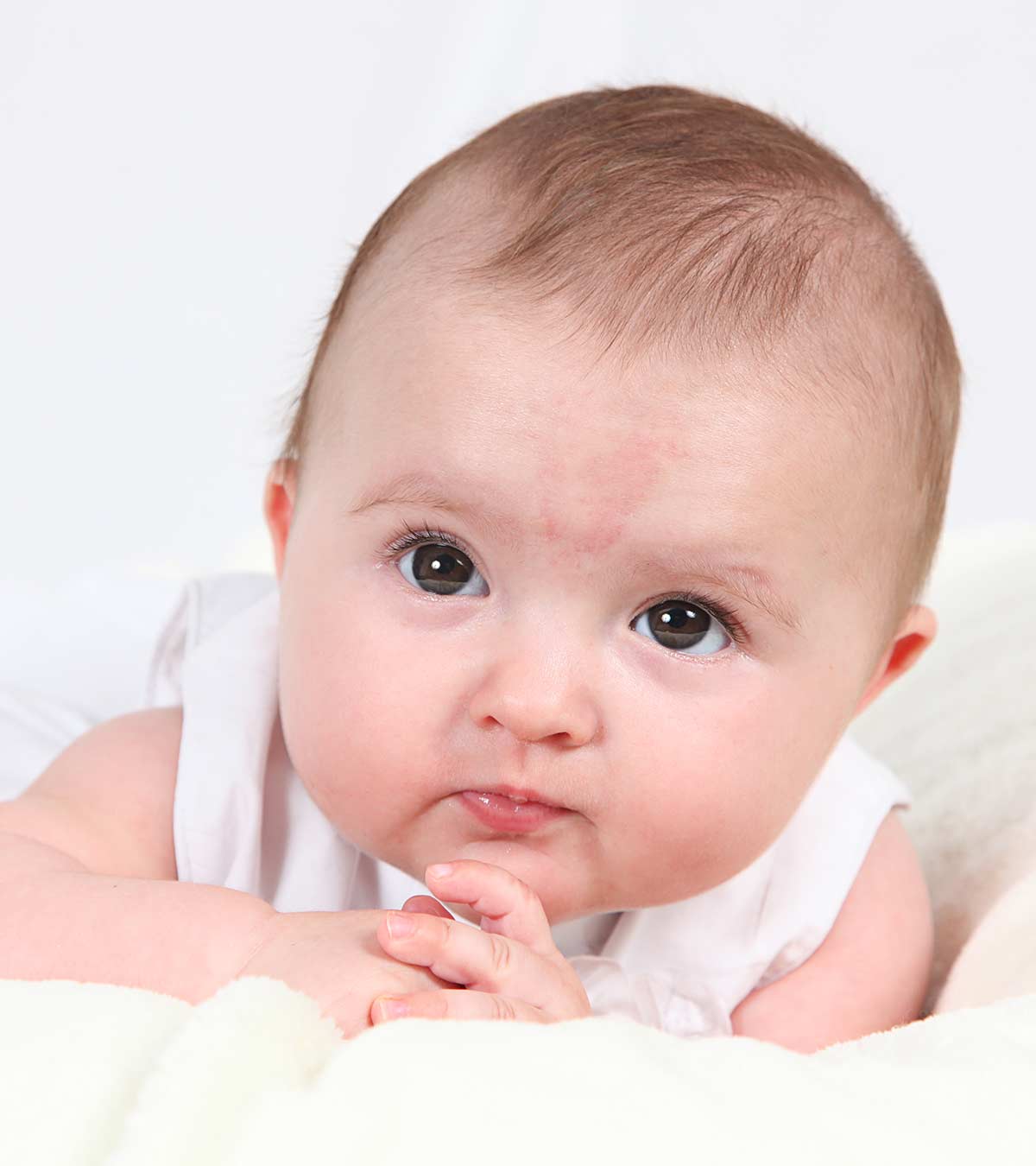 Birthmarks In Babies: Causes, Types And Treatment