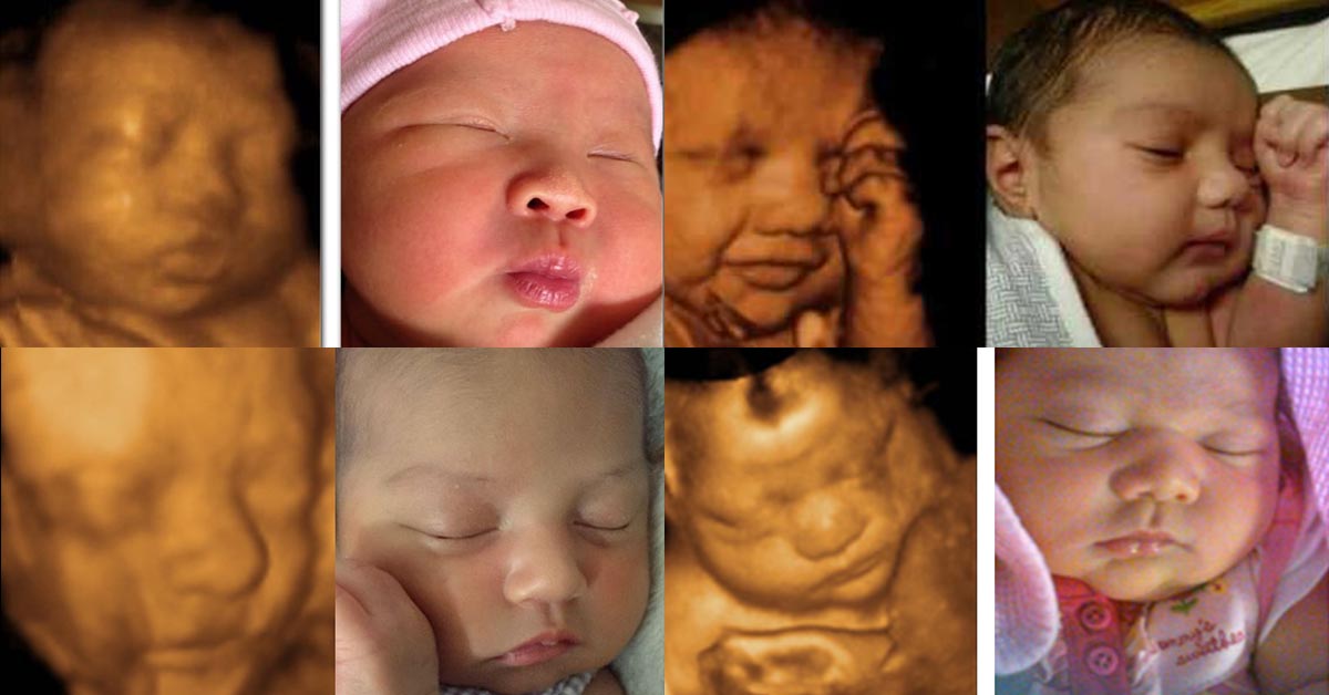 20 week ultrasound 3d pictures