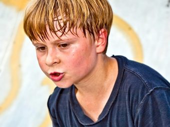 Excessive-Sweating-In-Children---Causes-And-Treatment