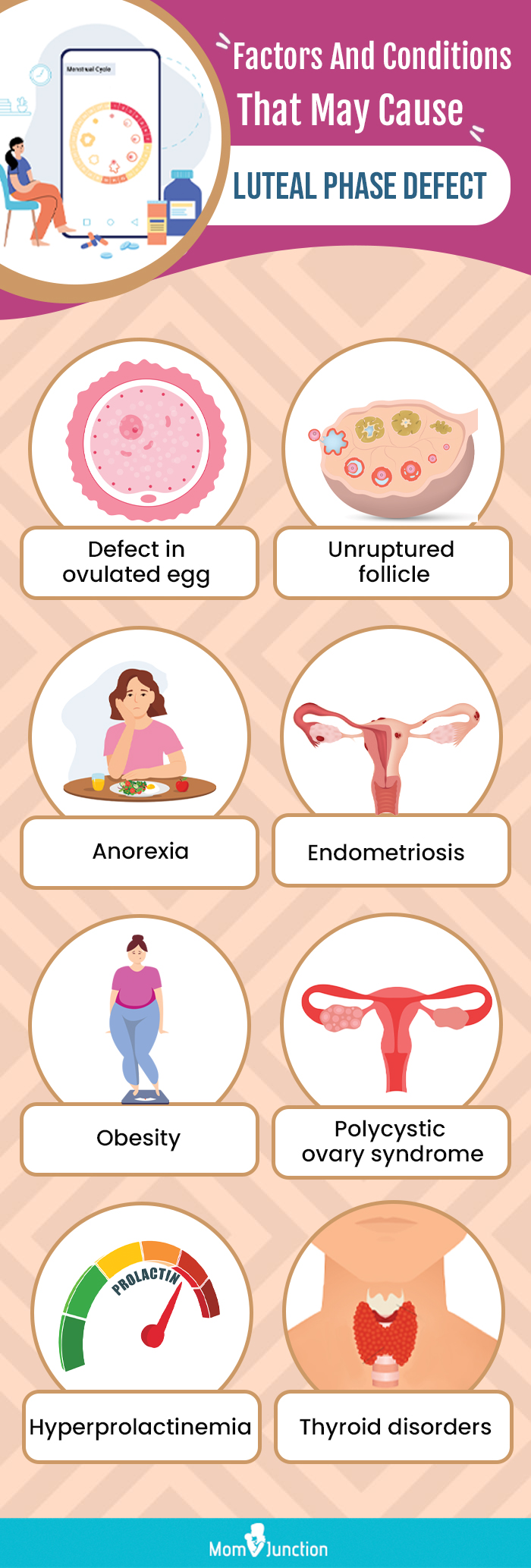 factors and conditions that may cause luteal phase defect (infographic)