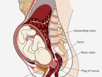 Uterine Prolapse During Pregnancy: Stages And Its Treatment