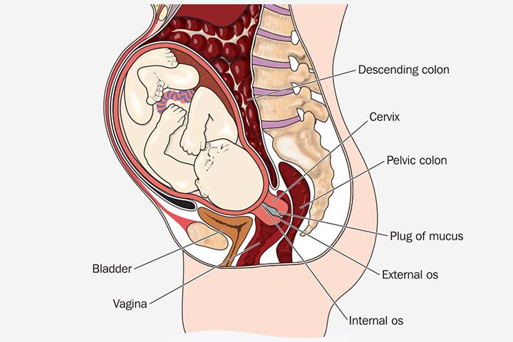 Uterine Prolapse In Pregnancy Signs Causes And Treatment