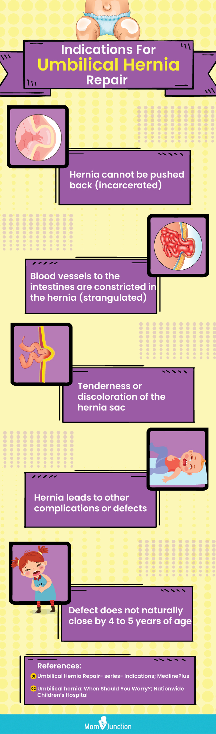 indications for umbilical hernia repair (infographic)