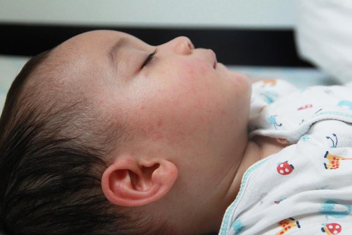 Wellbutrin while breastfeeding may cause seizures in babies