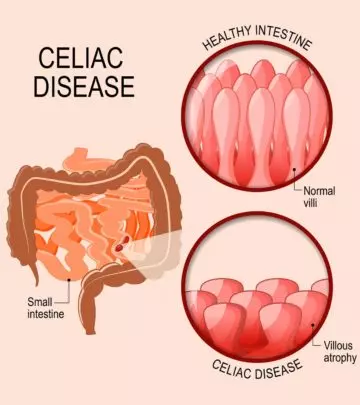Celiac Disease In Teens