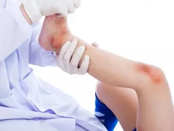 Causes of Knee Pain In Children,  When To See A Doctor And Treatment