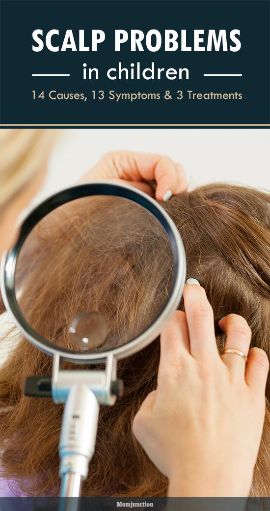 Scalp Problems In Children Causes, Symptoms And Treatment
