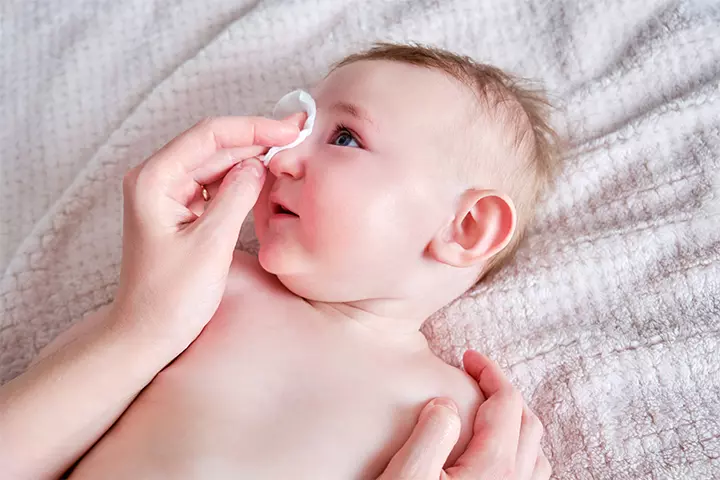 Use a sterile cotton ball to remove the allergen from the baby’s eyes gently