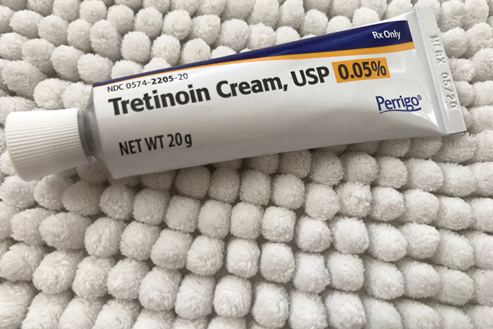 You can try tretinoin after consulting your doctor