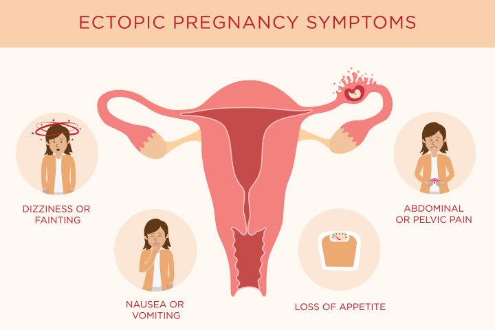 Pinkish discharge from your vagina may be a sign of ectopic pregnancy