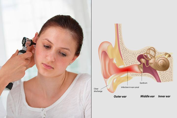 Middle Ear Infection Chart