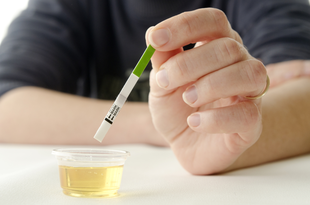 Dip the strip into the urine container