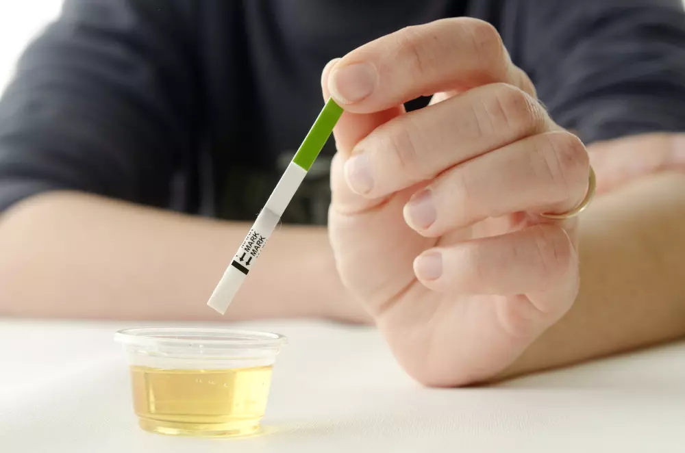 Dip the strip into the urine container