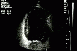 ultrasound image