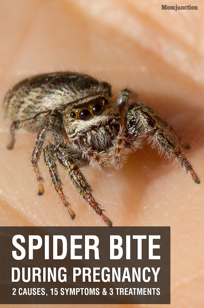 spider-bite-during-pregnancy-causes-symptoms-treatments