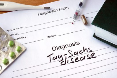 儿童的Tay-Sachs病 - 原因，症状和治疗