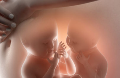 12与双胞胎妊娠有关的常见并发症
