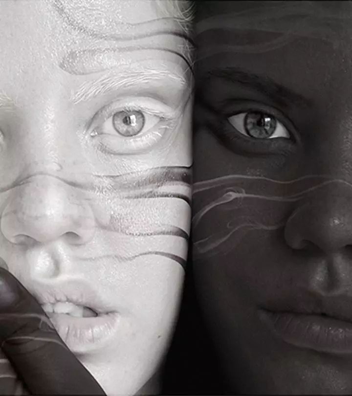 Twin Teens: One Black, One White, And A Legendary Story