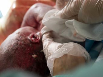 Woman Wakes Up After Childbirth, And This Is What She Finds (Scary)