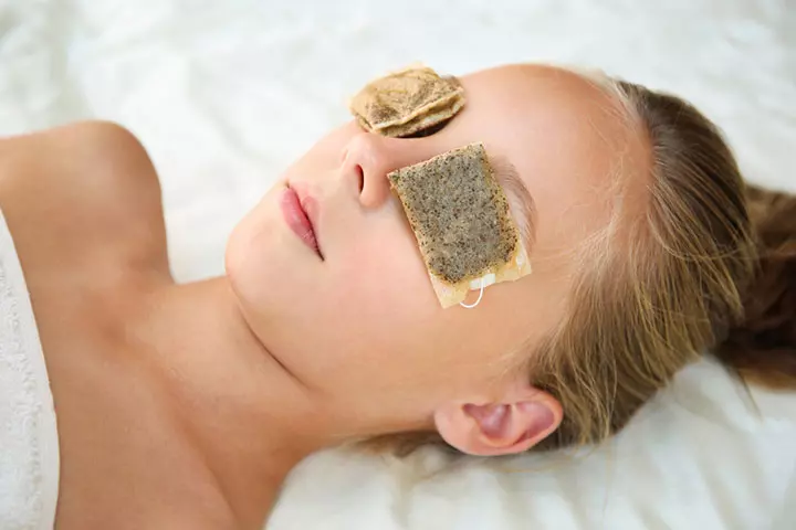 Cold tea bags help manage dark circles 