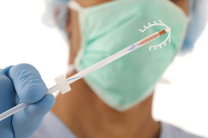 宫内装置（IUD）用于节育 - 优势和并发症