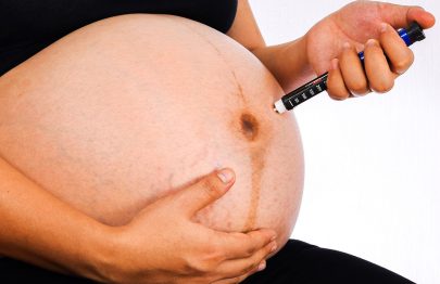 Is Imitrex (Sumatriptan) Safe During Pregnancy?