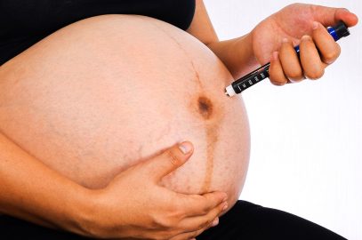Is Imitrex (Sumatriptan) Safe During Pregnancy?