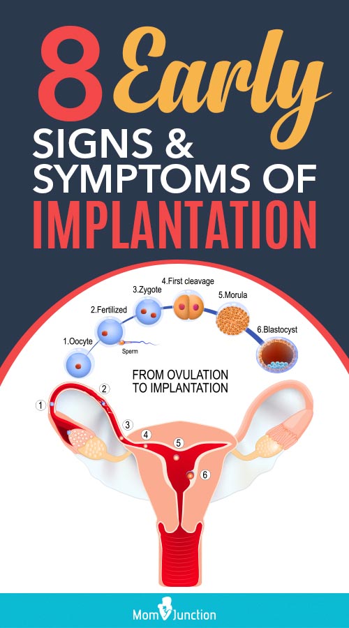 8 Early Signs And Symptoms Of Implantation