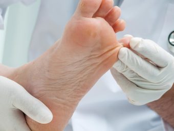 Athlete's Foot During Pregnancy: Causes And Home Remedies